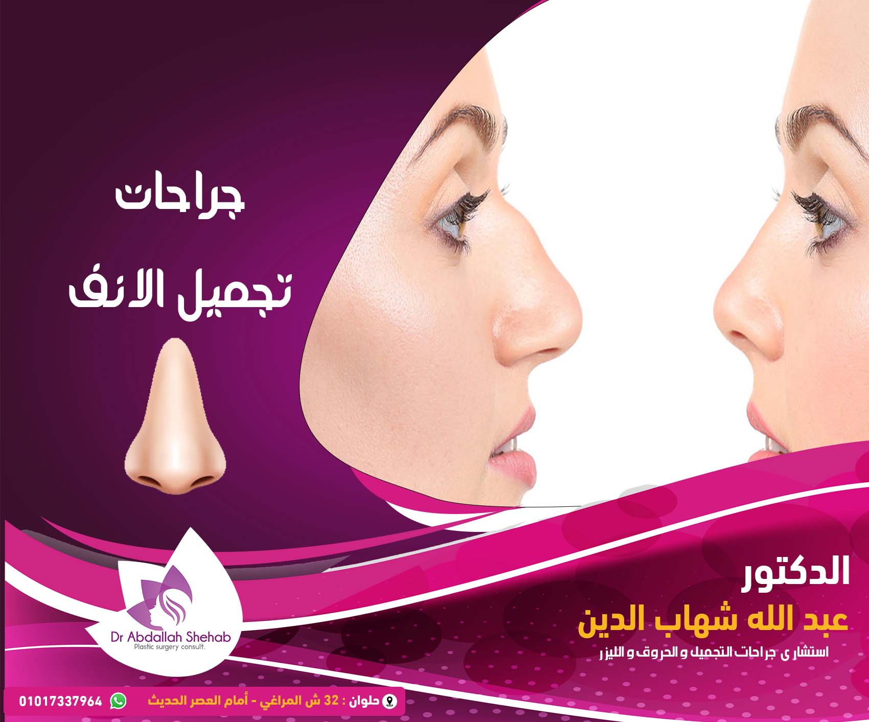 جراحات تجميل الأنف